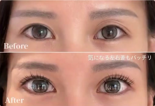 まつ毛をただ上げるだけではなく、|まぶたの厚み・かぶさり・|二重幅・左右差・|目の動きまで見ながら施術します