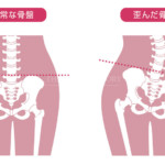 つらい肩こりや腰痛に