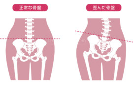 つらい肩こりや腰痛に